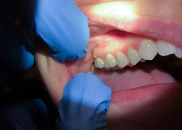 Best Emergency Dental Surgery in Castle Point, MO