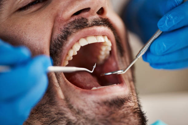 Best Emergency Treatment for Toothache in Castle Point, MO