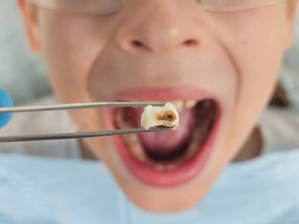 Best After-Hours Emergency Dentist in Castle Point, MO
