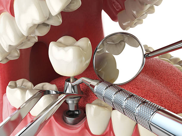 Best After-Hours Emergency Dentist in Castle Point, MO